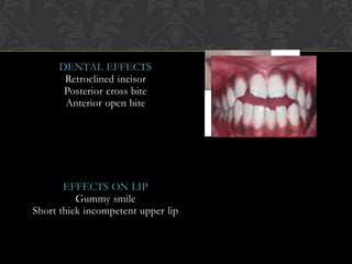 DENTAL EFFECTS
Retroclined incisor
Posterior cross bite
Anterior open bite
EFFECTS ON LIP
Gummy smile
Short thick incompetent upper lip
 