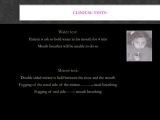 CLINICAL TESTS:
Water test:
Patient is ask to hold water in his mouth for 4 min
Mouth breather will be unable to do so
Mirror test:
Double sided mirror is held between the nose and the mouth
Fogging of the nasal side of the mirror nasal breathing
Fogging of oral side mouth breathing
 