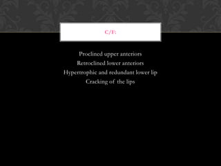 Proclined upper anteriors
Retroclined lower anteriors
Hypertrophic and redundant lower lip
Cracking of the lips
C/F:
 