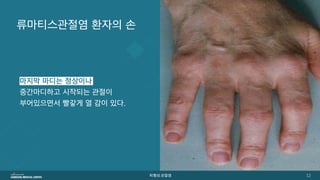 [삼성서울병원] 퇴행성관절염 