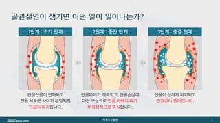 [삼성서울병원] 퇴행성관절염 
