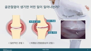 [삼성서울병원] 퇴행성관절염 