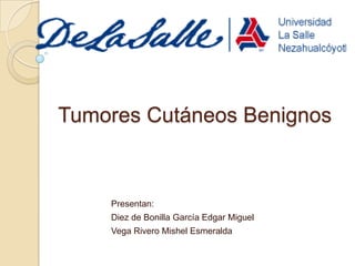 Tumores Cutáneos Benignos

Presentan:

Diez de Bonilla García Edgar Miguel
Vega Rivero Mishel Esmeralda

 