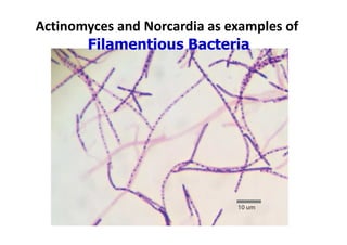 Filamentious Rods 3a. Bacterial Cell Biology_v2_ Differences btn eukaryotic and ...