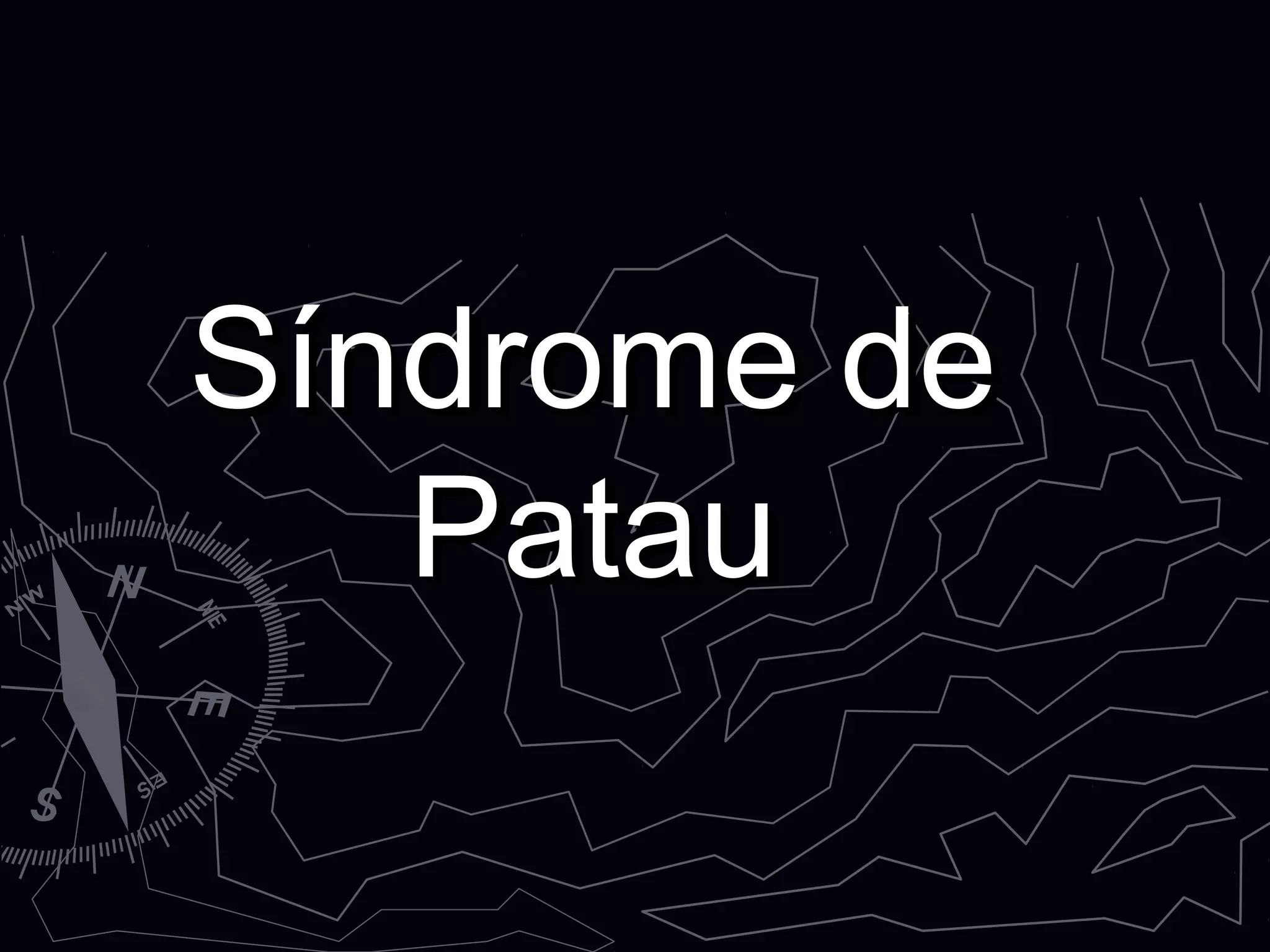 Síndrome deSíndrome de
PatauPatau
 