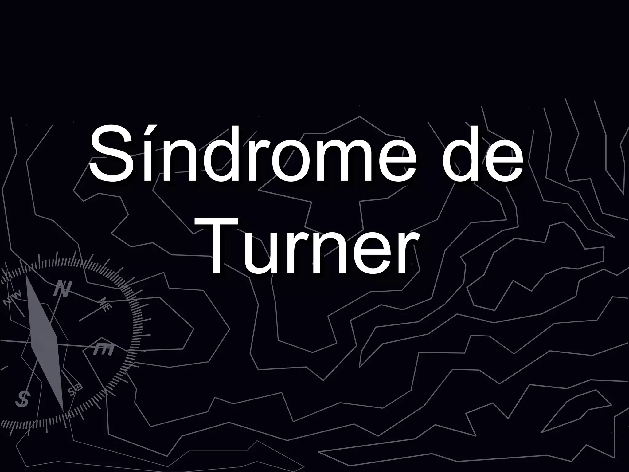 Síndrome deSíndrome de
TurnerTurner
 