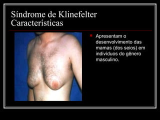 Síndrome de Klinefelter
Características
 Apresentam o
desenvolvimento das
mamas (dos seios) em
indivíduos do gênero
masculino.
 