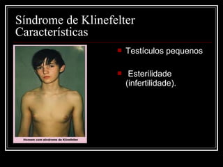  Testículos pequenos
 Esterilidade
(infertilidade).
Síndrome de Klinefelter
Características
 