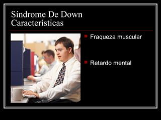  Fraqueza muscular
 Retardo mental
Síndrome De Down
Características
 