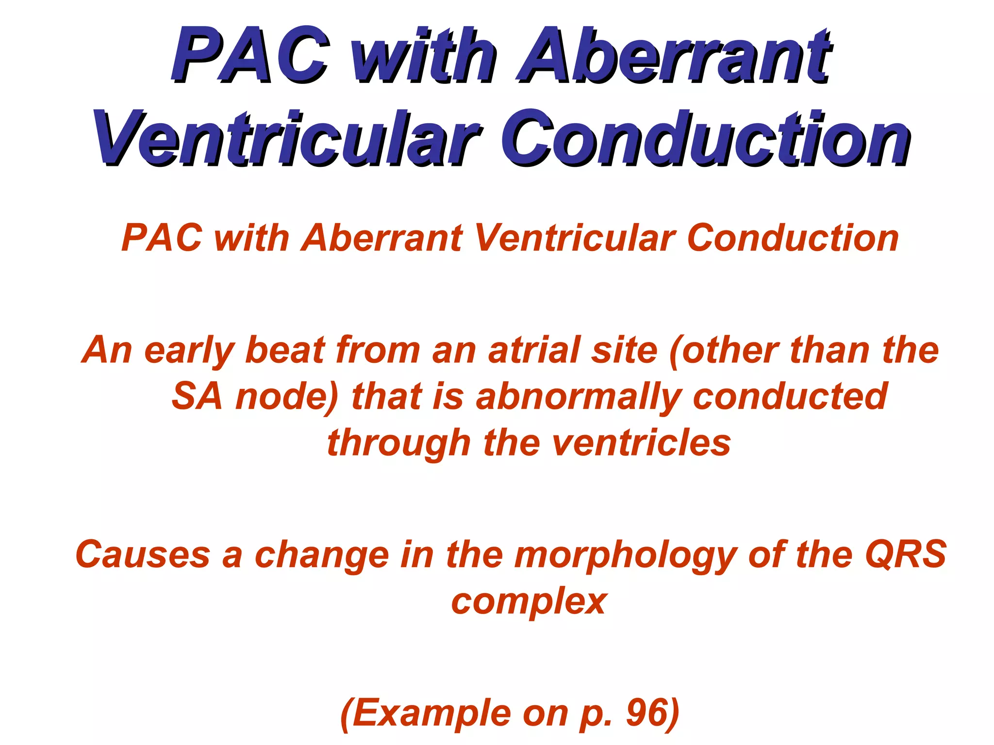 PAC with Aberrant Ventricular Conduction PAC with Aberrant Ventricular Conduction An early beat from an atrial site (other than the SA node) that is abnormally conducted through the ventricles Causes a change in the morphology of the QRS complex (Example on p. 96) 