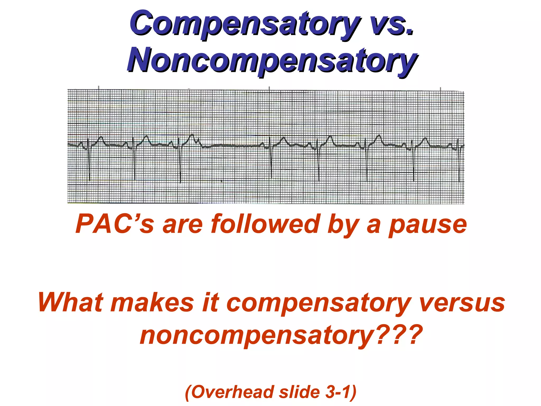 Compensatory vs. Noncompensatory PAC’s are followed by a pause What makes it compensatory versus noncompensatory??? (Overhead slide 3-1) 