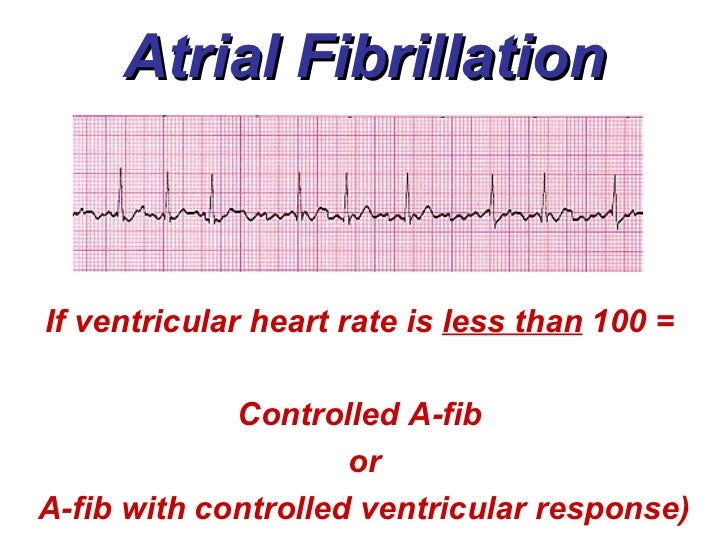 3a atrial rhythms