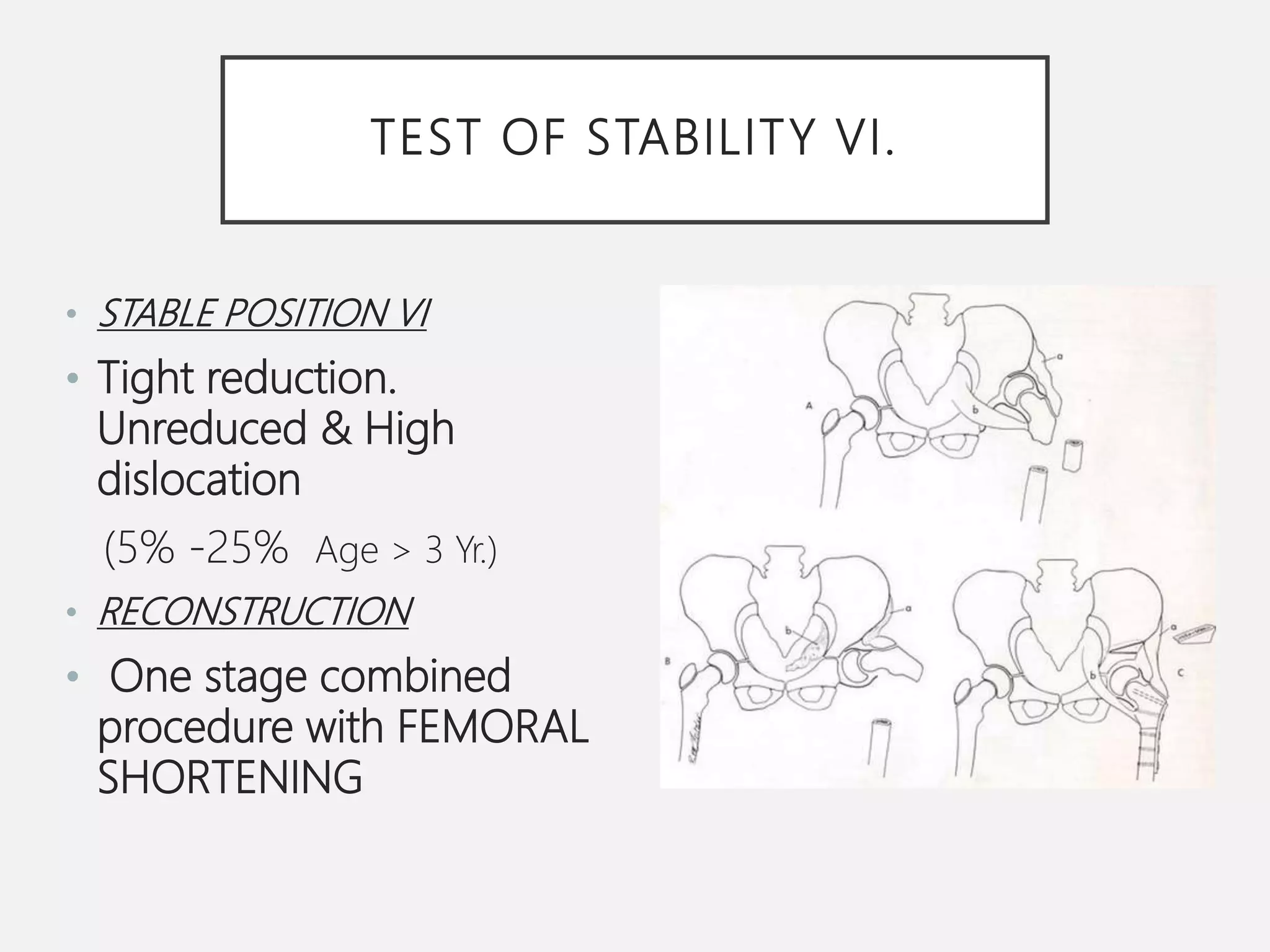 3a ddh open reduction principles & protocols | PPT