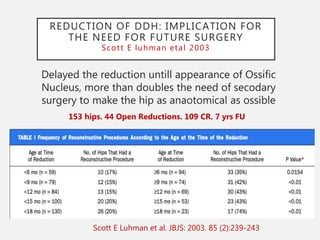 3a ddh open reduction principles & protocols | PPT