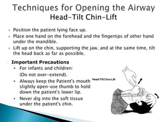 Position the patient lying face up.
 Place one hand on the forehead and the fingertips of other hand
under the mandible.
 Lift up on the chin, supporting the jaw, and at the same time, tilt
the head back as far as possible.
 Important Precautions
 For infants and children:
(Do not over-extend).
 Always keep the Patient's mouth
slightly open–use thumb to hold
down the patient's lower lip.
 Never dig into the soft tissue
under the patient's chin.
 