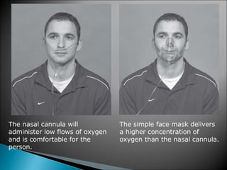 The nasal cannula will
administer low flows of oxygen
and is comfortable for the
person.
The simple face mask delivers
a higher concentration of
oxygen than the nasal cannula.
 