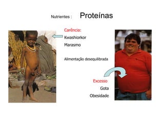 Nutrientes :    Proteínas
       Carência:
       Kwashiorkor
       Marasmo


       Alimentação desequilibrada




                        Excesso:
                            Gota
                      Obesidade
 