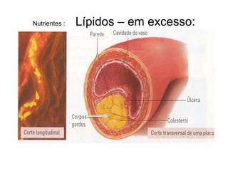 Nutrientes :   Lípidos – em excesso:
 