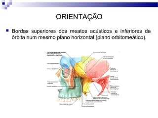 ORIENTAÇÃO
 Bordas superiores dos meatos acústicos e inferiores da
órbita num mesmo plano horizontal (plano orbitomeático).
 