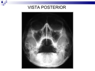 VISTA POSTERIOR
 