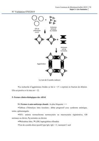 Cours Commun de Résidanat Juillet 2019
Sujet 3 : Les Anémies
70
N° Validation 07032019
Le test de Coombs indirect
wLa recherche d’agglutinines froides se fait à + 4° c exprimé en fraction de dilution.
Elle est positive si le titre est > 32.
5- Formes clinico-biologiques des AHAI
5-1 Formes à auto-anticorps chauds : la plus fréquente +++
wTableau d’hémolyse intra tissulaire : début progressif avec syndrome anémique,
ictère, splénomégalie.
wNFS : anémie normochrome normocytaire ou macrocytaire régénérative, GB
normaux ou élevés, Pq normales ou élevées
wäbilirubine libre, ä LDH, haptoglobine effondrée
wTest de coombs direct positif type IgG, IgG + C, rarement C seul
Agglutination
des GR
Anticorps
anti-Ig
humaines
Anticorps
sériques
du malade
GR de
phénotype
connu
 