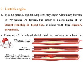 2. Unstable angina
1. In some patients, anginal symptoms may occur without any increase
in Myocardial O2 demand, but rather as a consequence of an
abrupt reduction in blood flow, as might result from coronary
thrombosis.
• Exposure of the subendothelial lipid and collagen stimulates the
formation of thrombus which causes sudden narrowing of the vessel.
 