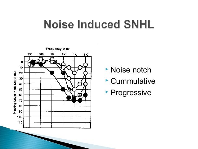 Ear Diagram Outer Middle Inner Choice Image - How To Guide 