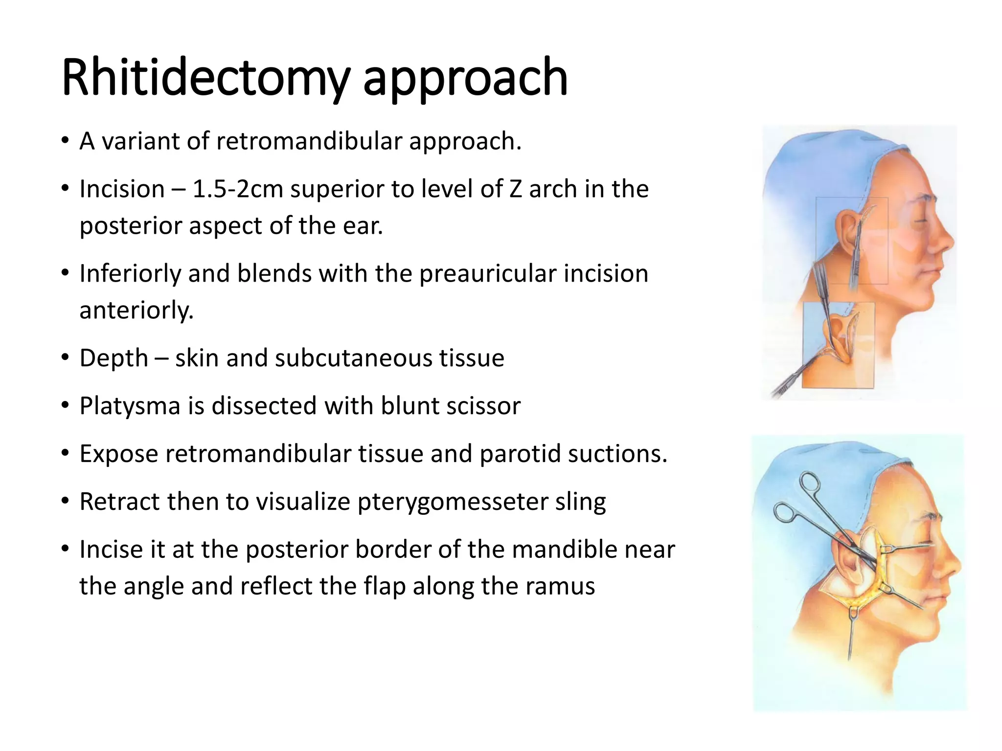 3 approaches to the tmj | PDF