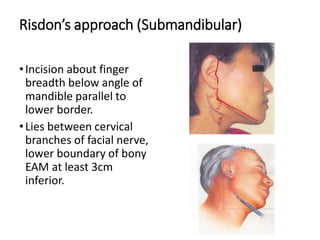 3 approaches to the tmj | PPT