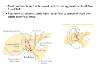 3 approaches to the tmj | PDF
