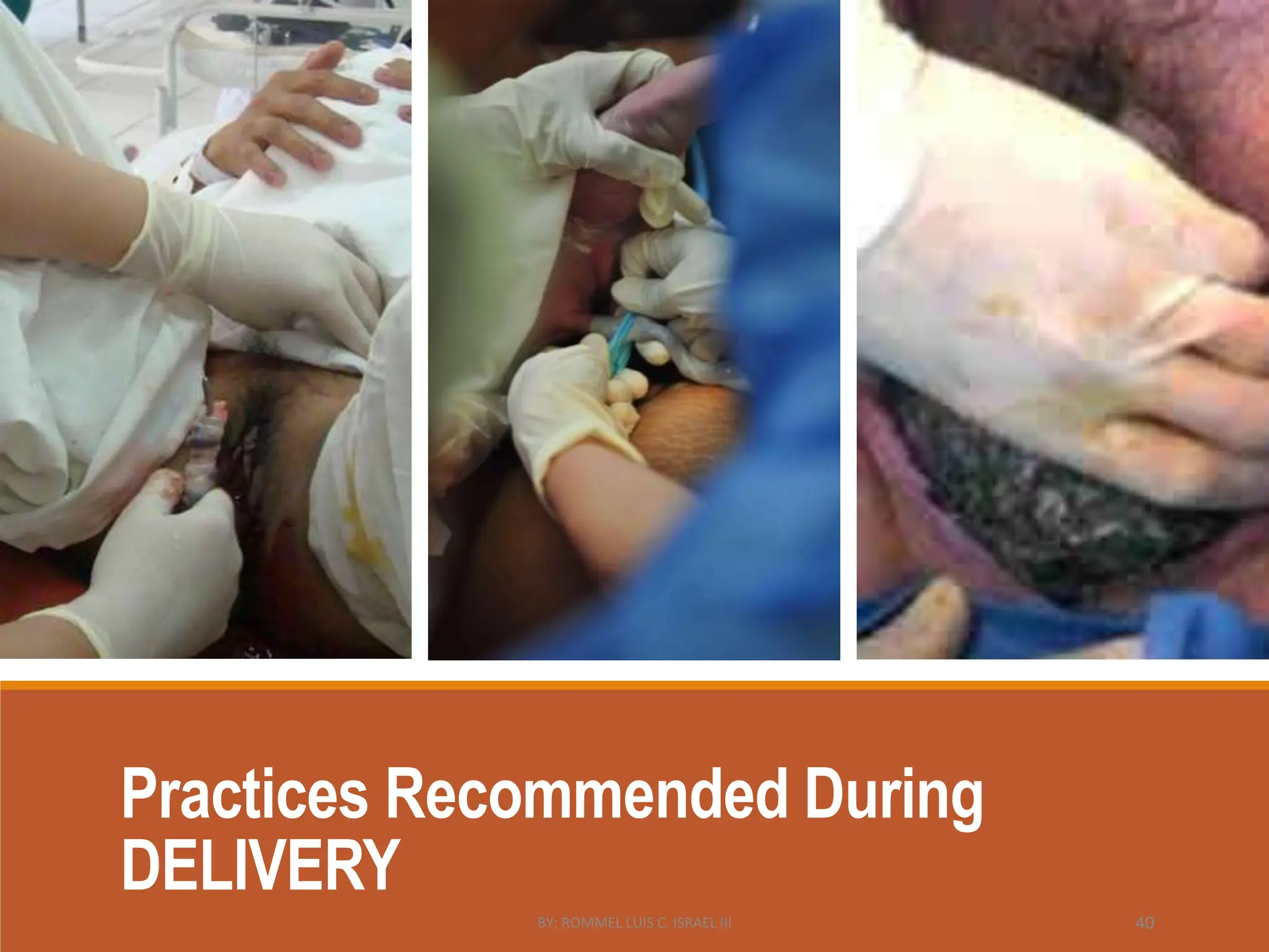 Practices Recommended During
DELIVERY
BY: ROMMEL LUIS C. ISRAEL III 40
 