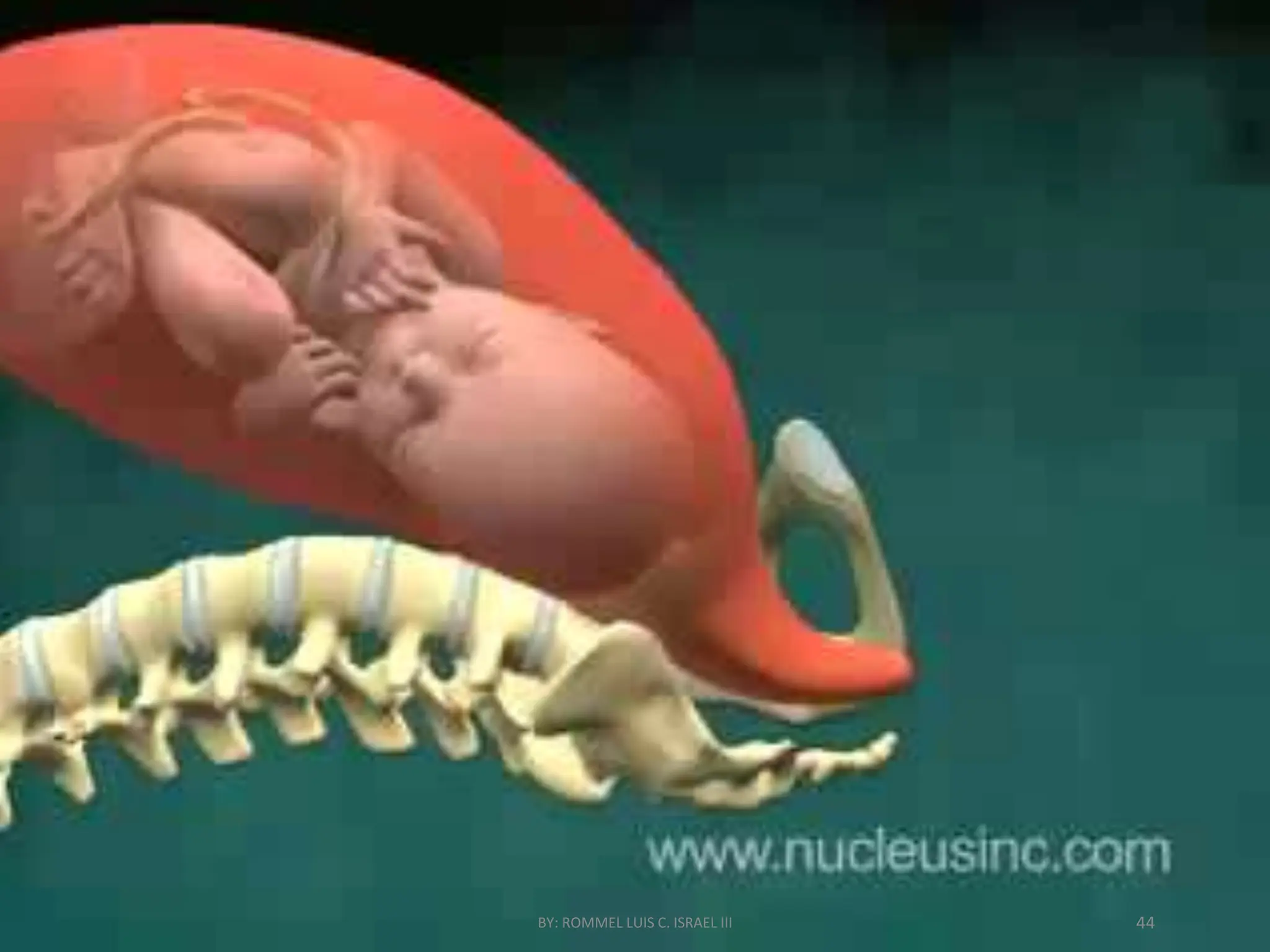 BY: ROMMEL LUIS C. ISRAEL III 44
 