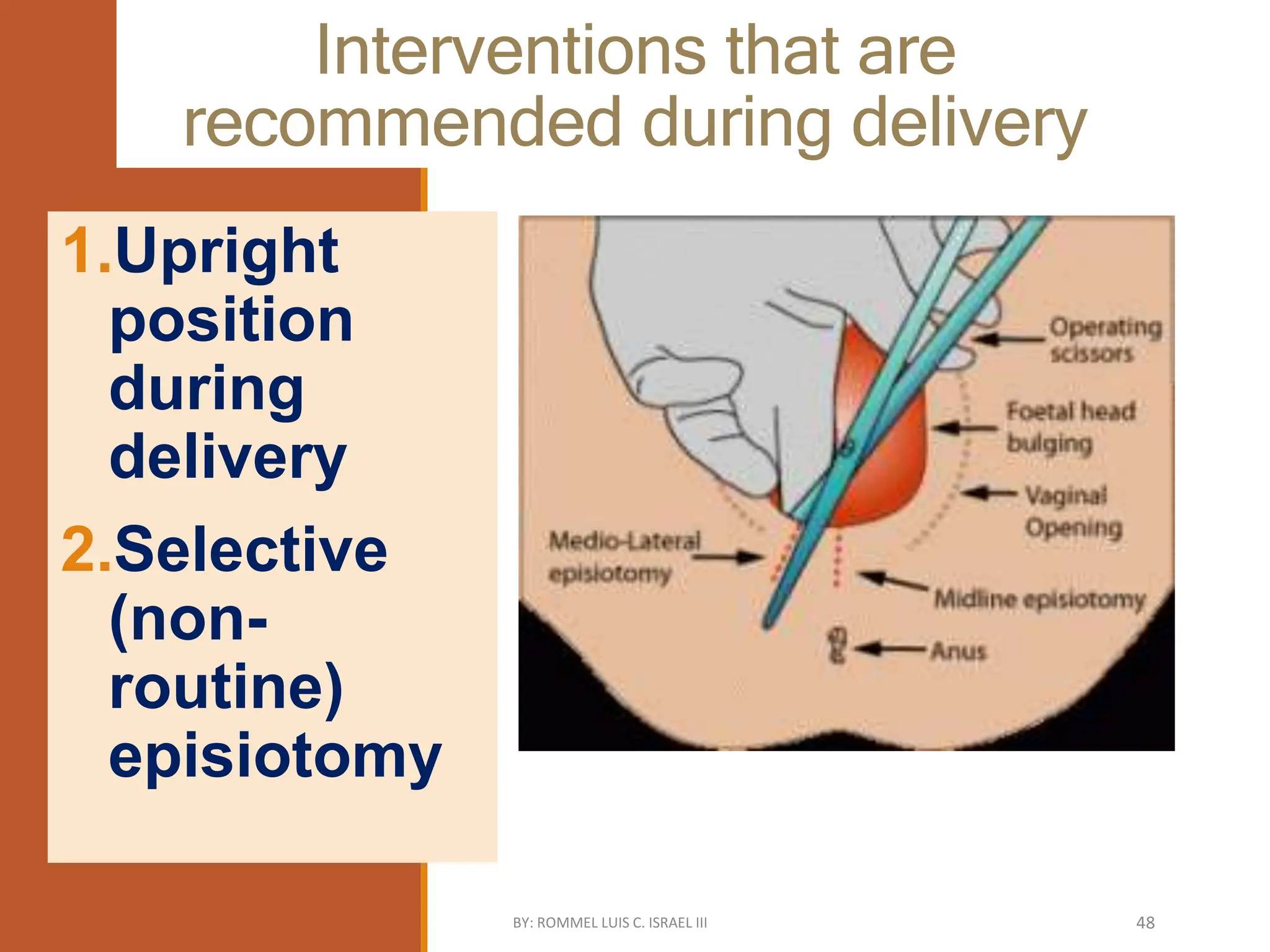 Interventions that are
recommended during delivery
1.Upright
position
during
delivery
2.Selective
(non-
routine)
episiotomy
BY: ROMMEL LUIS C. ISRAEL III 48
 