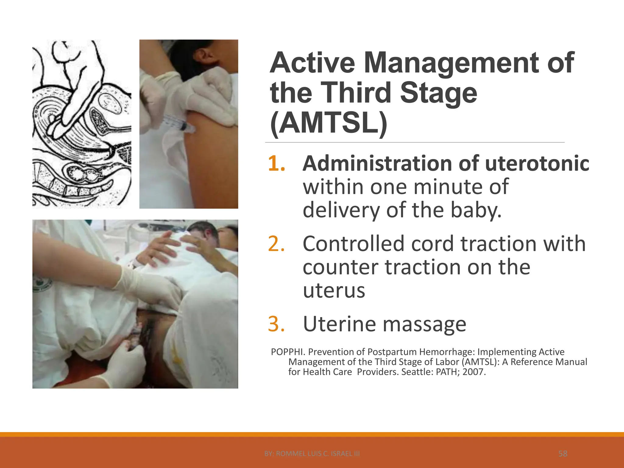 Active Management of
the Third Stage
(AMTSL)
1. Administration of uterotonic
within one minute of
delivery of the baby.
2. Controlled cord traction with
counter traction on the
uterus
3. Uterine massage
POPPHI. Prevention of Postpartum Hemorrhage: Implementing Active
Management of the Third Stage of Labor (AMTSL): A Reference Manual
for Health Care Providers. Seattle: PATH; 2007.
BY: ROMMEL LUIS C. ISRAEL III 58
 