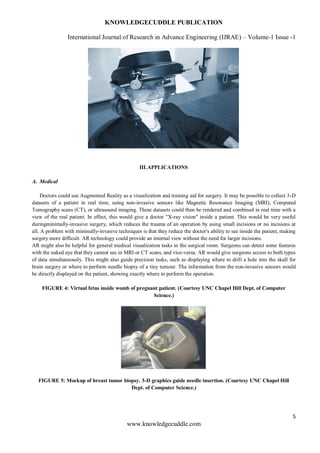 KNOWLEDGECUDDLE PUBLICATION
International Journal of Research in Advance Engineering (IJRAE) – Volume-1 Issue -1
5
www.knowledgecuddle.com
III.APPLICATIONS
A. Medical
Doctors could use Augmented Reality as a visualization and training aid for surgery. It may be possible to collect 3-D
datasets of a patient in real time, using non-invasive sensors like Magnetic Resonance Imaging (MRI), Computed
Tomography scans (CT), or ultrasound imaging. These datasets could then be rendered and combined in real time with a
view of the real patient. In effect, this would give a doctor "X-ray vision" inside a patient. This would be very useful
duringminimally-invasive surgery, which reduces the trauma of an operation by using small incisions or no incisions at
all. A problem with minimally-invasive techniques is that they reduce the doctor's ability to see inside the patient, making
surgery more difficult. AR technology could provide an internal view without the need for larger incisions.
AR might also be helpful for general medical visualization tasks in the surgical room. Surgeons can detect some features
with the naked eye that they cannot see in MRI or CT scans, and vice-versa. AR would give surgeons access to both types
of data simultaneously. This might also guide precision tasks, such as displaying where to drill a hole into the skull for
brain surgery or where to perform needle biopsy of a tiny tumour. The information from the non-invasive sensors would
be directly displayed on the patient, showing exactly where to perform the operation.
FIGURE 4: Virtual fetus inside womb of pregnant patient. (Courtesy UNC Chapel Hill Dept. of Computer
Science.)
FIGURE 5: Mockup of breast tumor biopsy. 3-D graphics guide needle insertion. (Courtesy UNC Chapel Hill
Dept. of Computer Science.)
 