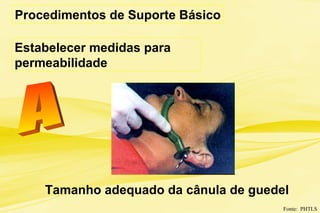 Procedimentos de Suporte Básico
Estabelecer medidas para
permeabilidade
Fonte: PHTLS
Tamanho adequado da cânula de guedel
 
