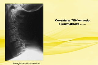 Considerar TRM em todoConsiderar TRM em todo
o traumatizado .......o traumatizado .......
Luxação de coluna cervical
 