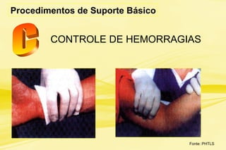 CONTROLE DE HEMORRAGIAS
Procedimentos de Suporte Básico
Fonte: PHTLS
 