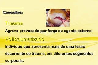 Conceitos:Conceitos:Conceitos:Conceitos:
TraumaTrauma
Agravo provocado por força ou agente externo.
PolitraumatizadoPolitraumatizado
Indivíduo que apresenta mais de uma lesão
decorrente de trauma, em diferentes segmentos
corporais.
 