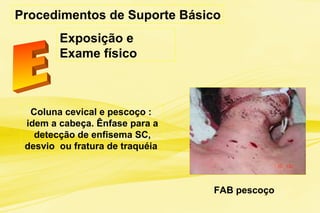 Procedimentos de Suporte Básico
Exposição e
Exame físico
FAB pescoço
Coluna cevical e pescoço :
idem a cabeça. Ênfase para a
detecção de enfisema SC,
desvio ou fratura de traquéia
 