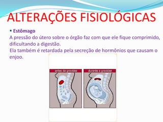 ALTERAÇÕES FISIOLÓGICAS
 Estômago
A pressão do útero sobre o órgão faz com que ele fique comprimido,
dificultando a digestão.
Ela também é retardada pela secreção de hormônios que causam o
enjoo.
 