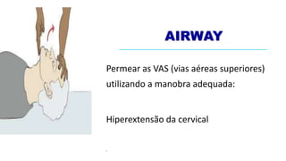 AIRWAY
Permear as VAS (vias aéreas superiores)
utilizando a manobra adequada:
Hiperextensão da cervical
•
 