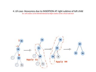 4. LR case- Heavyness due to INSERTION AT right subtree of left child
Do Left rotation at the leftchild followed by Right rotation at the critical node level
 