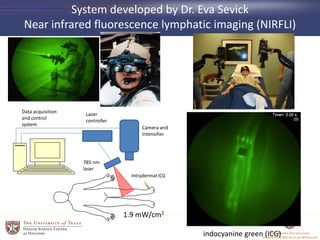 Camera and
intensifier
Laser
controller
785 nm
laser
Data acquisition
and control
system
Intradermal ICG
1.9 mW/cm2
System developed by Dr. Eva Sevick
Near infrared fluorescence lymphatic imaging (NIRFLI)
indocyanine green (ICG)
 