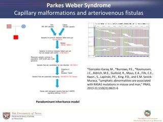*Gonzalez-Garay, M., *Burrows, P.E., *Rasmussen,
J.C., Aldrich, M.E., Guilloid, R., Maus, E.A., Fife, C.E.,
Kwon., S., Lapinski, P.E., King. P.D., and E.M. Sevick-
Muraca, “Lymphatic abnormalities are associated
with RASA1 mutations in mouse and man,” PNAS,
2013 21;110(21):8621-6
Parkes Weber Syndrome
Capillary malformations and arteriovenous fistulas
Paradominant inheritance model
 