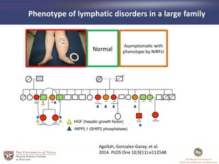 Phenotype of lymphatic disorders in a large family
Agollah, Gonzalez-Garay, et al.
2014. PLOS One 10;9(11):e112548
 