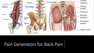 Pain Generators for Back Pain
 