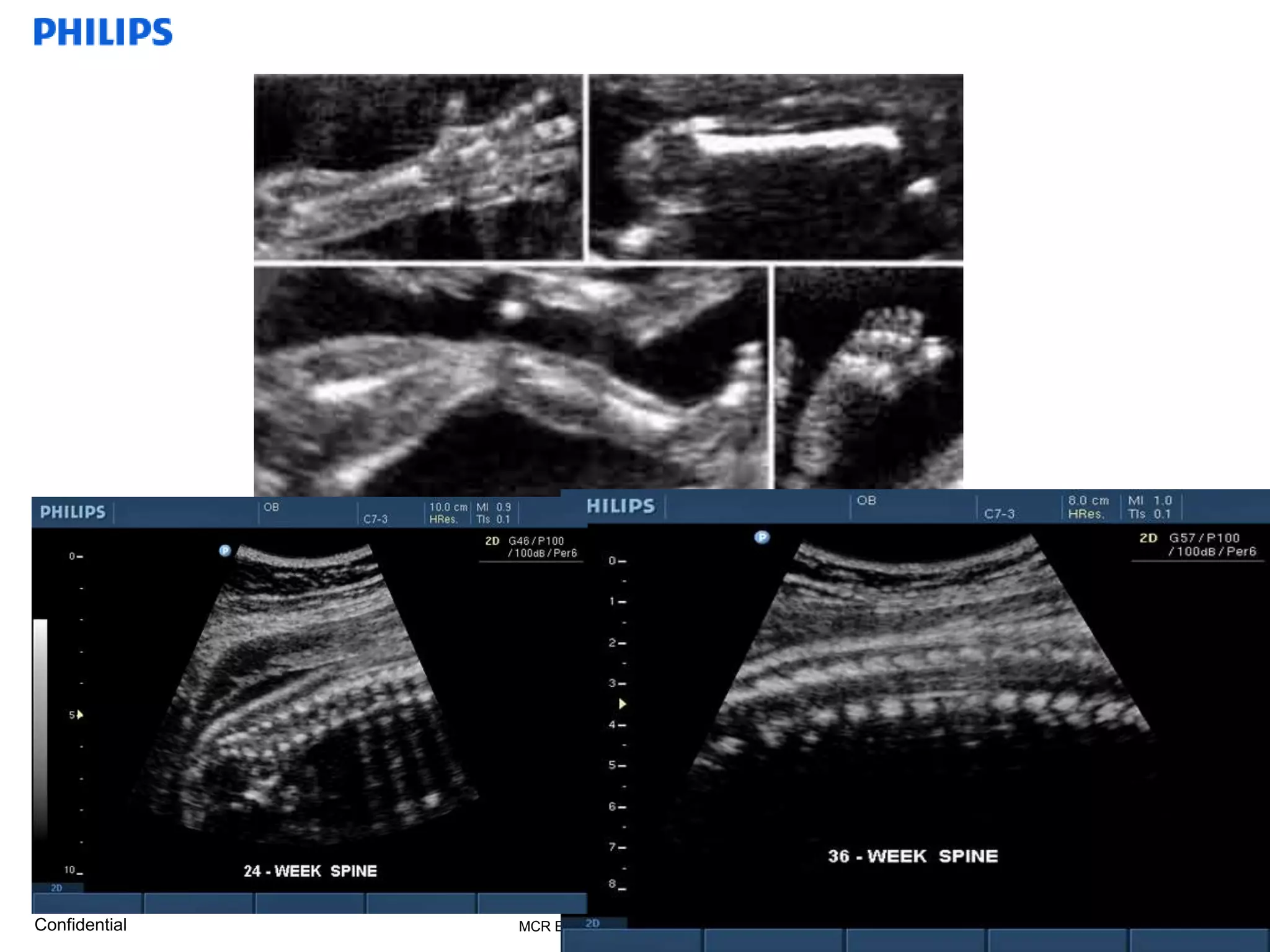 basic anatomy ob & gyn | PPTX