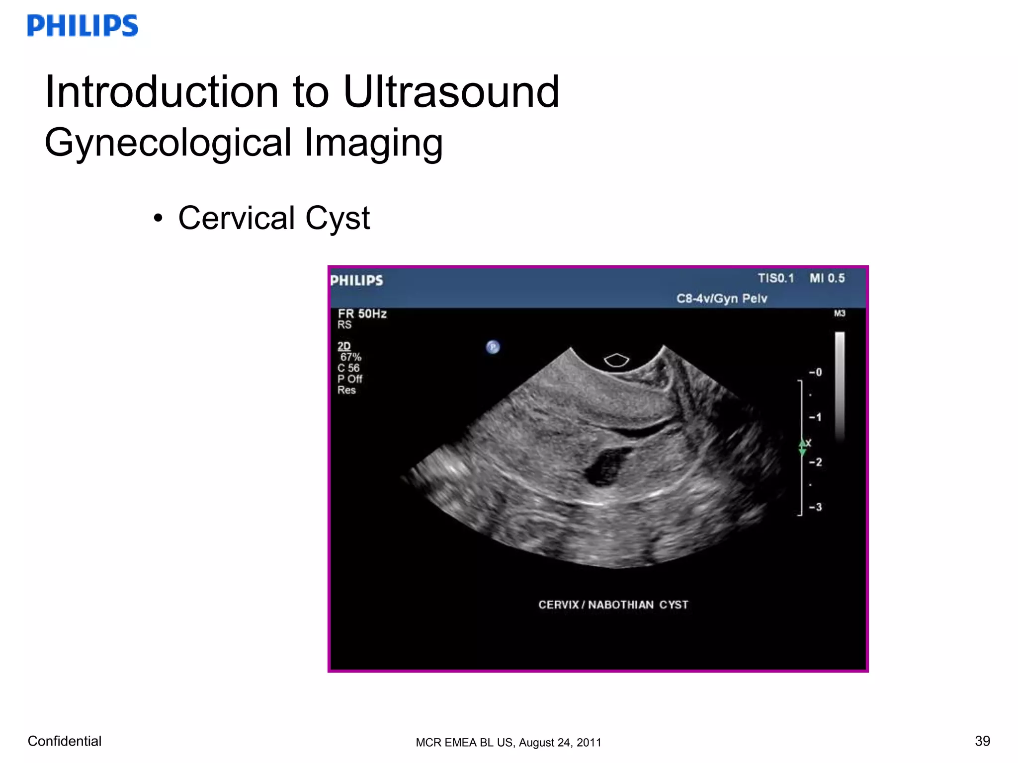 basic anatomy ob & gyn | PPTX