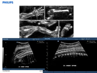 basic anatomy ob & gyn | PPTX
